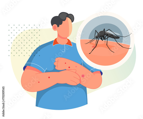 Mosquito biting on Human Skin - Stock Illustration