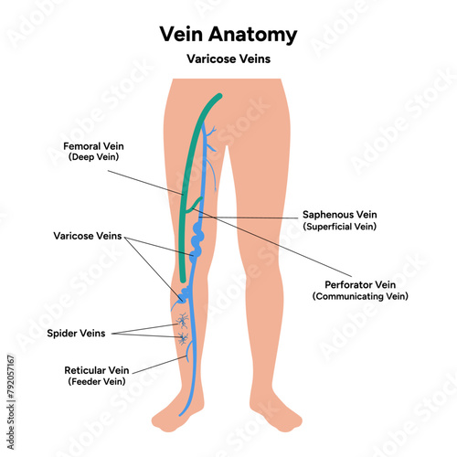 Vein anatomy, varicose veins