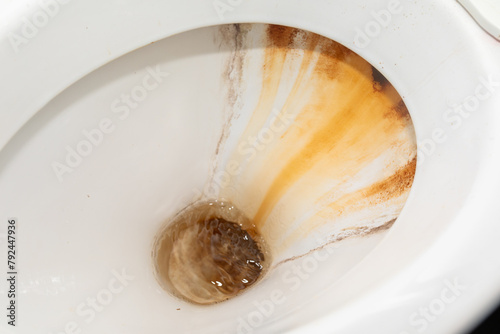 White Toilet With Brown Substance