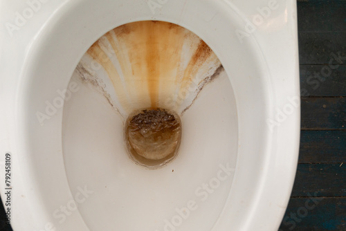 Close-Up of Toilet With Brown Substance