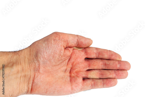 the palm of a man's hand highlighted on white