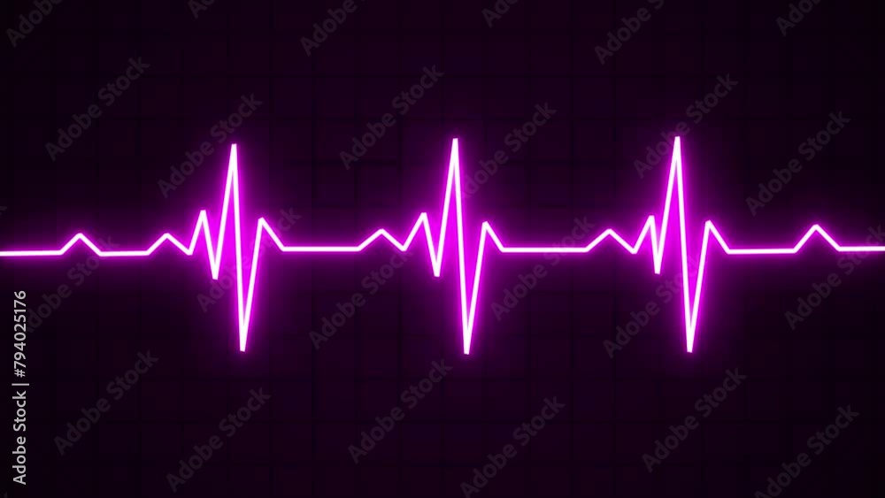 Glowing neon purple color heartbeat rate and pulse line with grid, seamless and loop motion. Cardiogram cardiograph oscilloscope screen Glowing neon purple color heartbeat rate and pulse line with grid, seamless and loop motion. Cardiogram cardiograph oscilloscope screen