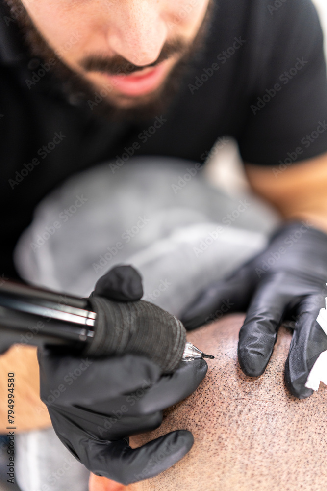 Detalle de maquina de tatuar realizando micropigmentación capilar
