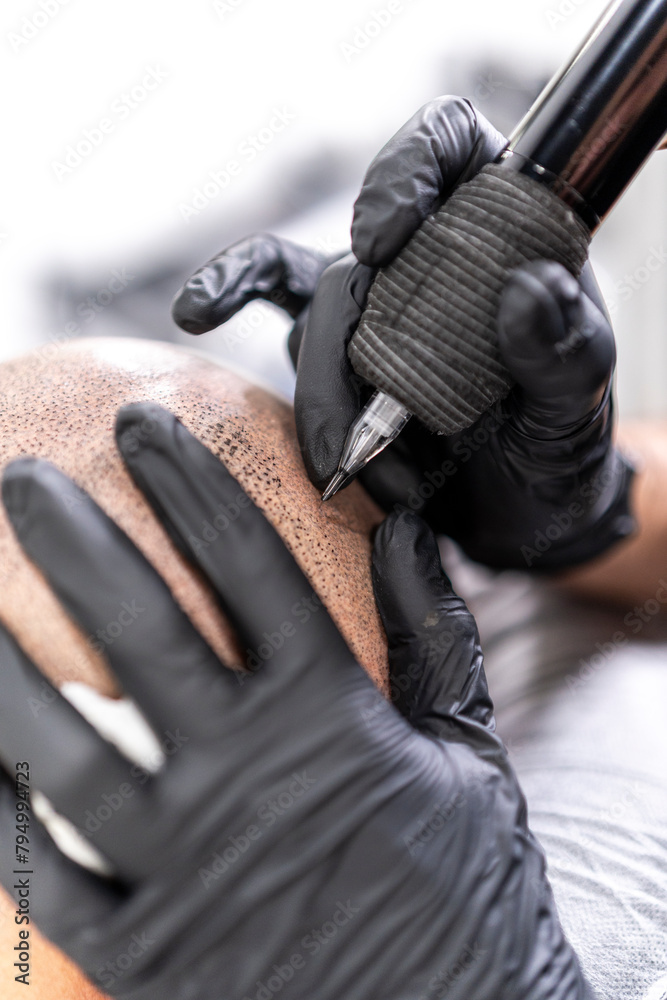 Detalle de maquina de tatuar realizando micropigmentación capilar