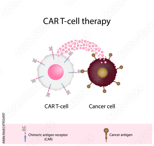 CAR T-cell therapy and Cancer treatment . Chimeric antigen receptor T cells. T cell receptor proteins that have been engineered to kill cancer ells. CAR T cells immunotherapy. Cancer therapy.  photo