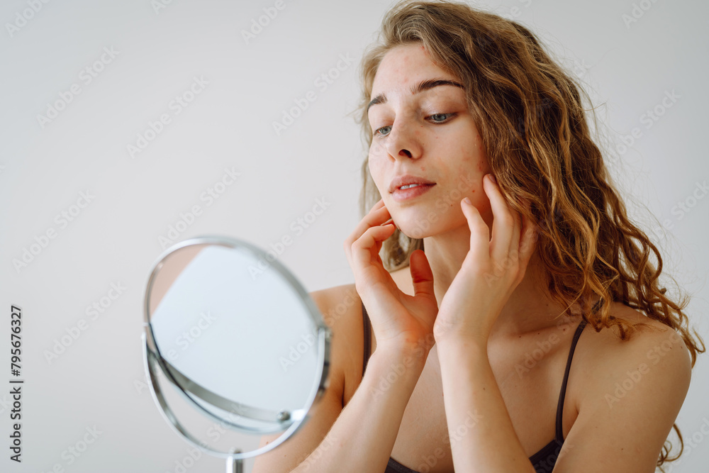 Portrait of a young woman without makeup with Acne skin. Natural beauty. Medical care and treatment concept. Portrait of a young woman without makeup with Acne skin. Natural beauty. Medical care and treatment concept.