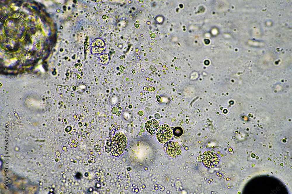 green mucus and coughing up phlegm under the microscope looking at influenza cells and cold snot