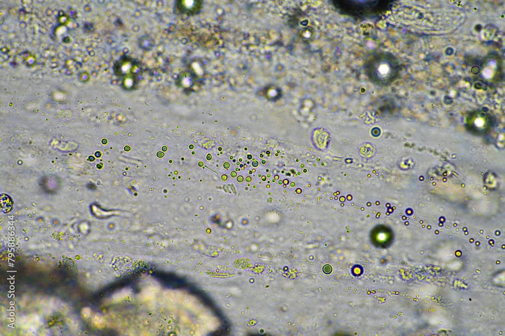 green mucus and coughing up phlegm under the microscope looking at