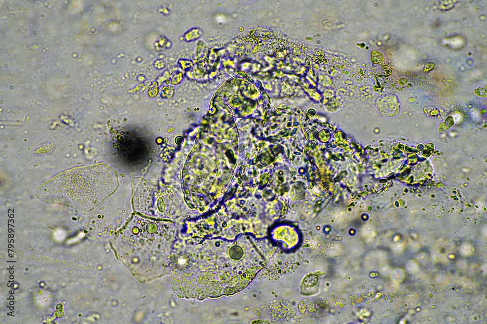 green mucus and coughing up phlegm under the microscope looking at