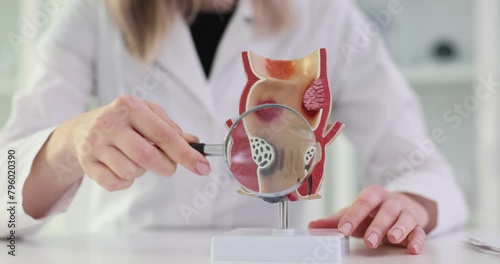 Proctologist with a magnifying glass in his hand showing rectum pathologies on an anatomical model photo