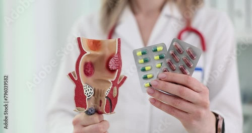 Doctor proctologist holding blisters with pills and anatomical model of rectum photo