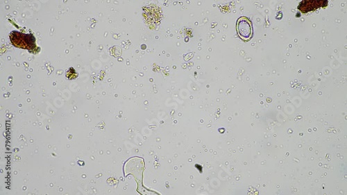 soil microorganisms in a soil life sample from a sustainable agriculture farm. living food web or bacteria fungi and protozoa photo