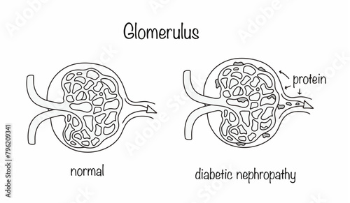 Glomerulus