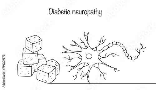 Diabetic neuropathy