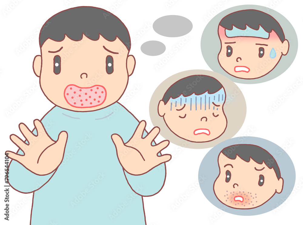 病気・疾病のイラスト - 手足口病・ウイルス性感染症