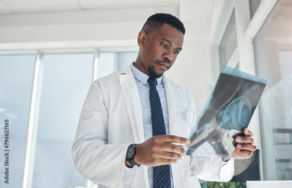 Fototapeta premium Hospital, doctor and black man with xray in office for neurology results, healthcare and assessment. Medical professional, clinic and person with radiology film for neuroscience, analysis and review