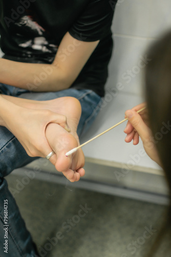 A dermatologist treats a wart with liquid nitrogen on a patient   s leg. skin lesions
