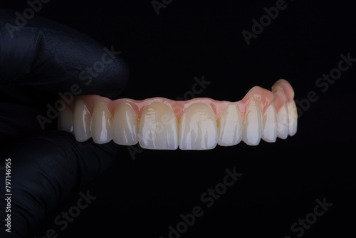 Photography Two stages of making full dental zirkonium prosthesis on titanium bar