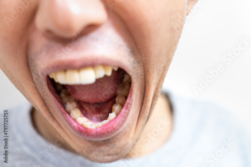 Bild auf Leinwand 激しく怒っている男性のイメージ写真