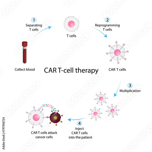 CAR T-cell therapy. Chimeric antigen receptor T cell ,CAR T cell, for use in immunotherapy. Genetic engineering. Chemotherapy. vector illustration. photo