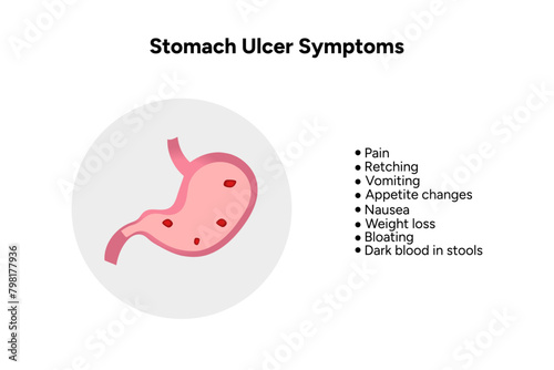 Stomach Ulcer