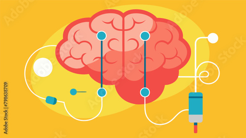 A representation of deep brain stimulation being used to treat symptoms of obsessivecompulsive disorder with the electrodes targeting areas.