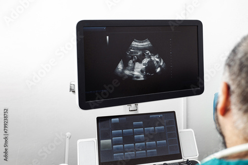 Medical Personal using an Ultrasound Machine. Xray Concept.