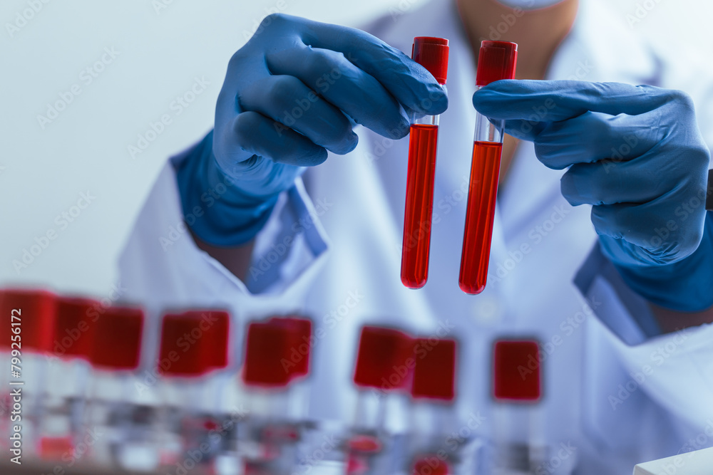 Hands of a doctor or female doctor collecting blood sample tubes from rack with analyzer in lab. Doctor holding blood test tube in research laboratory red blood cells Hands of a doctor or female doctor collecting blood sample tubes from rack with analyzer in lab. Doctor holding blood test tube in research laboratory red blood cells