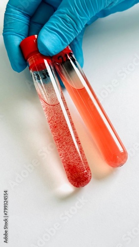 Foto Agglutination reaction in laboratory test tubes