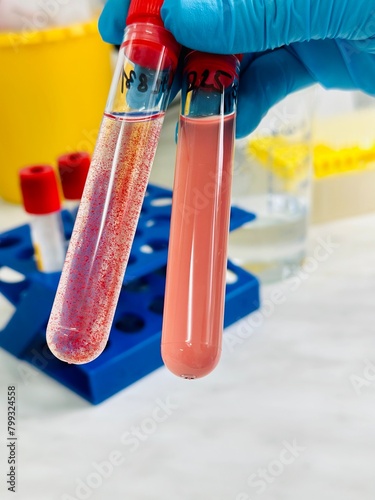 Agglutination reaction in test tubes. Rh factor testing. photo