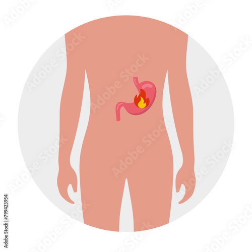Stomach problem, acid stomach