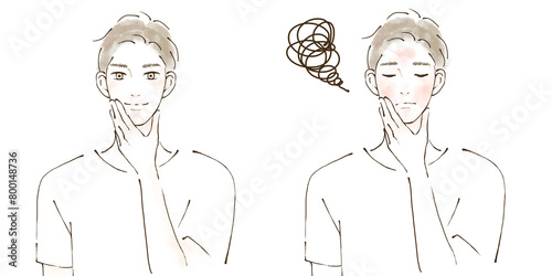 肌荒れ改善　before after男性のイラストセット　アレルギー　アトピー