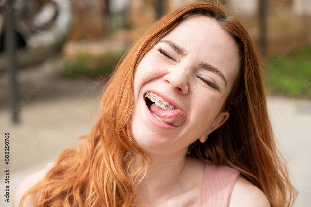 Young woman with braces on her teeth smiles and shows her tongue outdoors. Young woman with braces on her teeth smiles and shows her tongue outdoors.