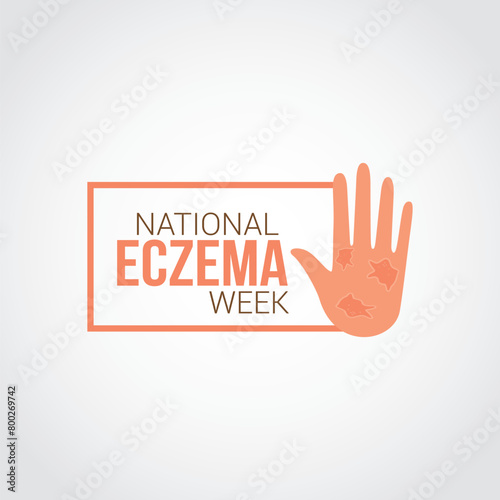 National Eczema Week vector illustration. National Eczema Week themes design concept with flat style vector illustration. Suitable for greeting card, poster and banner.