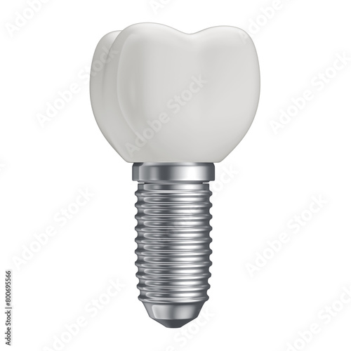 Realistic 3D Modeling PNG File of Dental Implant Tooth with Transparent Background
