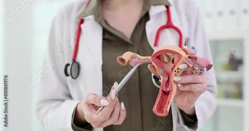 Female gynecologist demonstrates a model of the female reproductive system