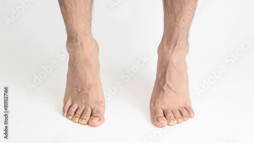 Adult man foot viewed from the inner ankle, standing on tiptoe, left foot with space for text, white background, full foot