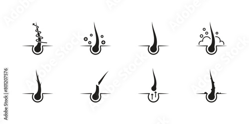 Treatment and problems with hair. A set of hair icons. Hair loss, sectioning, strengthening, nutrition and various hair care.