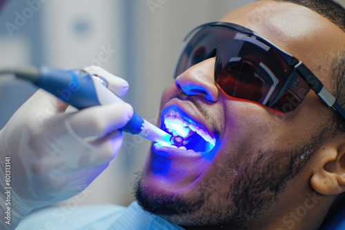 African-American Man Receiving Dental Treatment with UV Light  Showcasing Advanced Oral Care