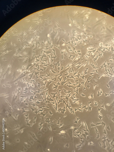 Photo taken from a microscope observing human cell culture in a biological research laboratory in vitro