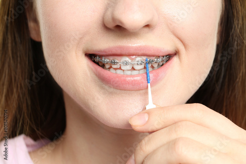 Smiling woman with dental braces cleaning teeth using interdental brush, closeup