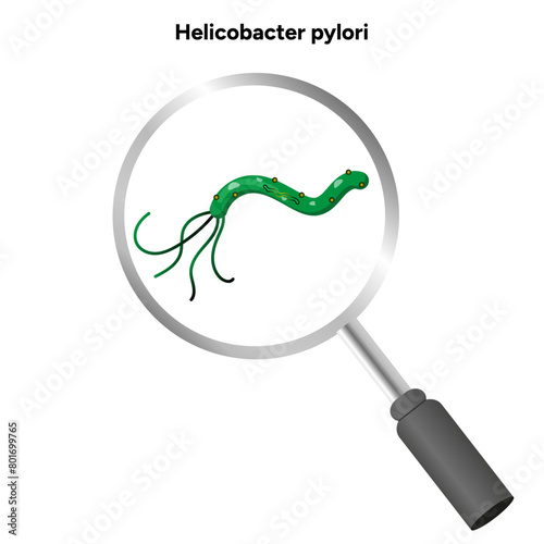 Helicobacter pylori zoom