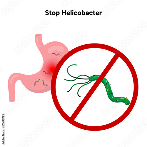 Stop Helicobacter pylori