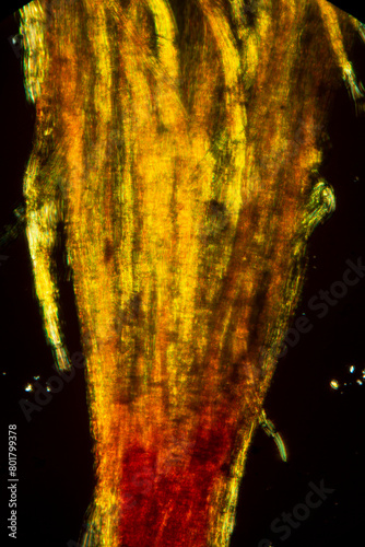 Hairy calyptra of the capsule of Ulota crispa, a moss. photo