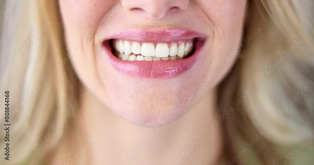 Dentistry, process and woman teeth for before and after with whitening for oral care cosmetics. Happy, smile and female person with mouth for dental hygiene treatment for stain removal versus results