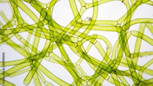 Fotografie The water net (Hydrodictyon sp) under microscope