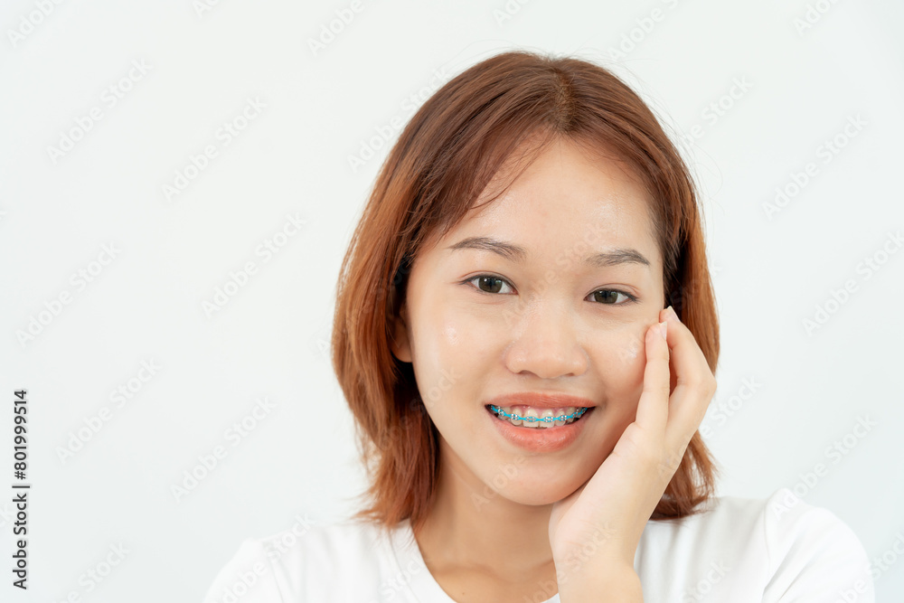 Treatment. Dental Care. Beautiful asian Woman Healthy Smile.Metal Brackets on Teeth. young Female Smile with Braces and show beautiful of teeth, Care after braces, confident in orthodontics Treatment. Dental Care. Beautiful asian Woman Healthy Smile.Metal Brackets on Teeth. young Female Smile with Braces and show beautiful of teeth, Care after braces, confident in orthodontics