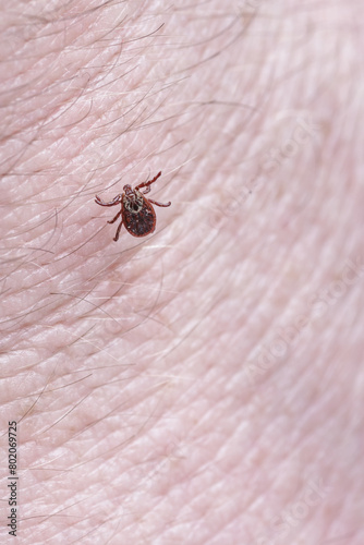 Adult female tick - Ixodes ricinus.A predatory parasitic tick crawls along the human body.Carrier of infectious diseases as encephalitis or Lyme borreliosis.