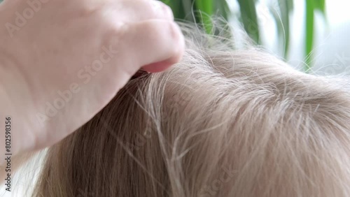 Close-up female hands, mother carefully searches lice and nits in daughter's hair, ensuring hygiene and well-being, Pediculosis infestation, Family Bonding, Health and Hygiene photo