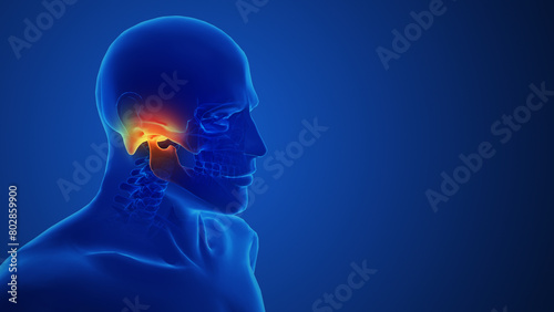 Concept of Medical Painful temporomandibular joint